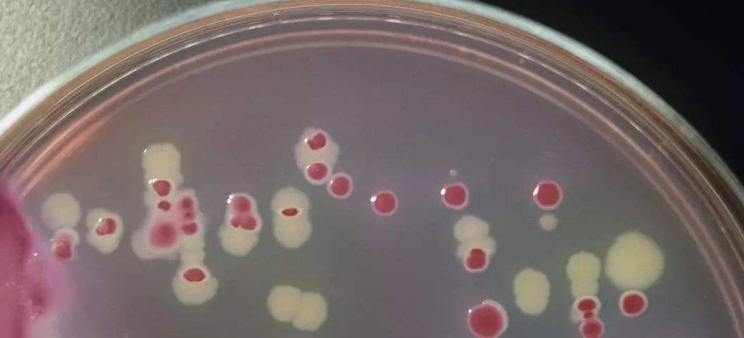 加TTC檢測菌落總數